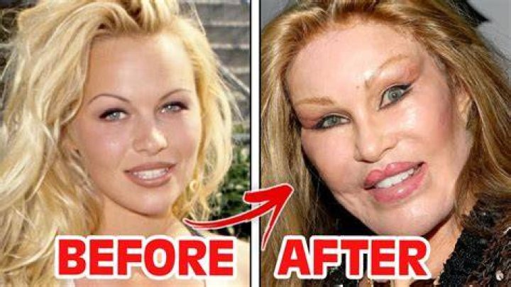 Did Jersey Shore Cast Get Plastic Surgery? – Celebrity