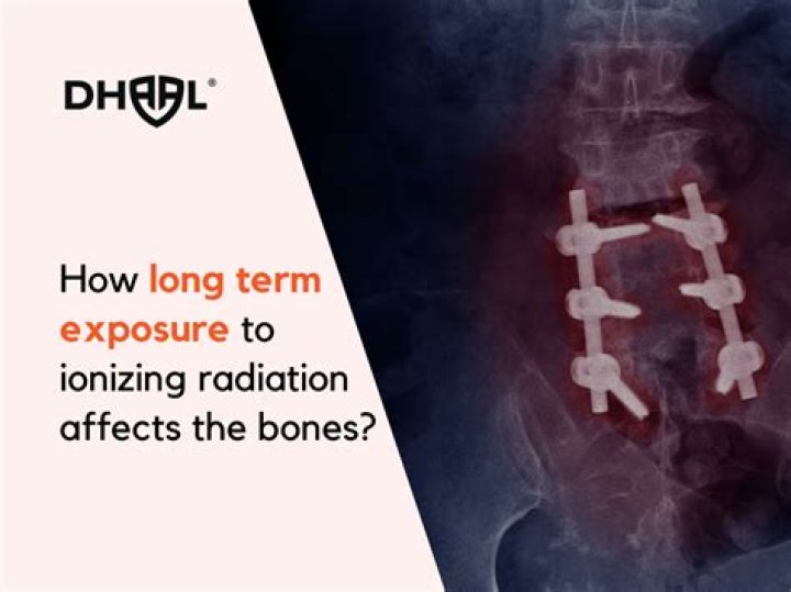 Exposure to Ionizing Radiation Can Increase Risk of Heart Disease