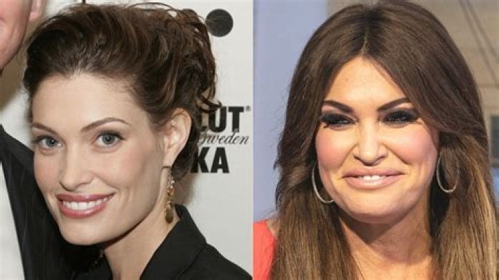 Kimberly Guilfoyle Plastic Surgery